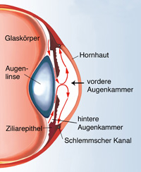 Grüner Star: Was bietet die Naturheilkunde?