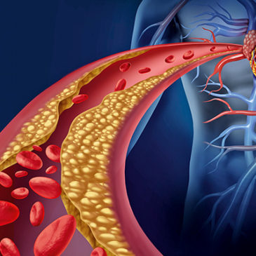 Neue Wirkstoffe gegen Arteriosklerose