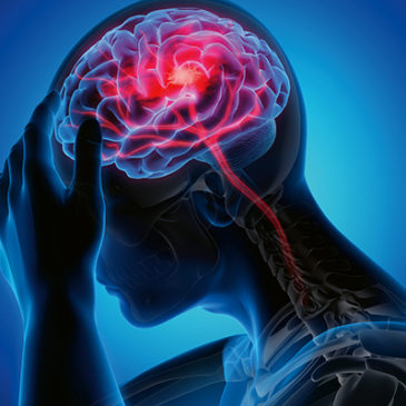 Nicht auszuhalten: Cluster-Kopfschmerz