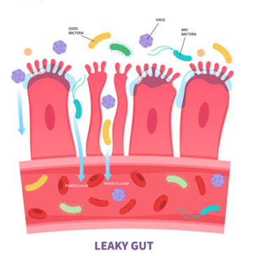 Leaky Gut: Nur gereizt oder schon durchlässig?